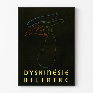 dyskinesie-biliaire