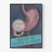 Anatomisk plakat af pylorus og mavesæk - medicinsk vægdekoration